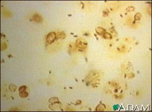 Legionnaires' disease organism, legionella