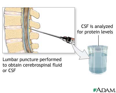 CSF protein test