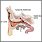 Ear tube insertion  - series