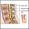 Lumbar spinal surgery - series