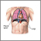 Pneumothorax - series