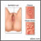 Genital sores (female)