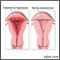Abnormal menstrual periods