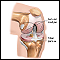 Knee joint replacement - series