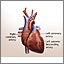 Heart bypass surgery - series