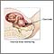 Internal fetal monitoring