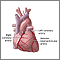 Anterior heart arteries