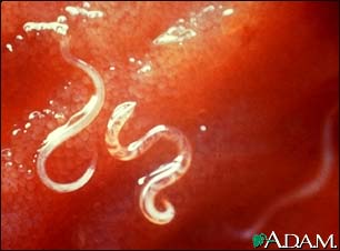Hookworm - Ancyclostoma caninum