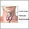Parathyroidectomy - series
