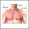 Pulmonary lobectomy  - series