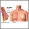 Breast augmentation - series