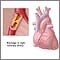 Coronary artery blockage