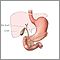 Gallbladder anatomy